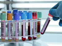 Лаборатории Мурино: СИТИЛАБ, ДНКОМ, LabQuest и другие (2026)